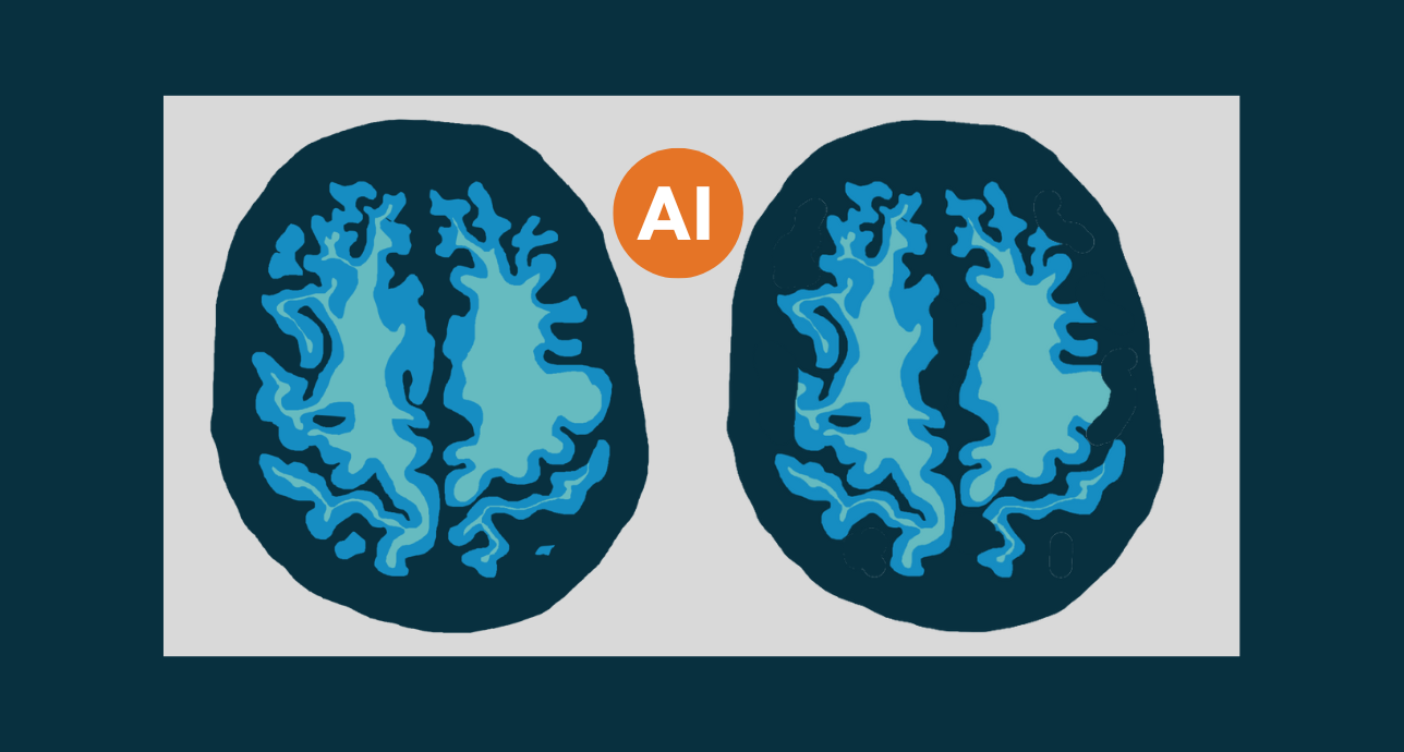 Dementia and ai